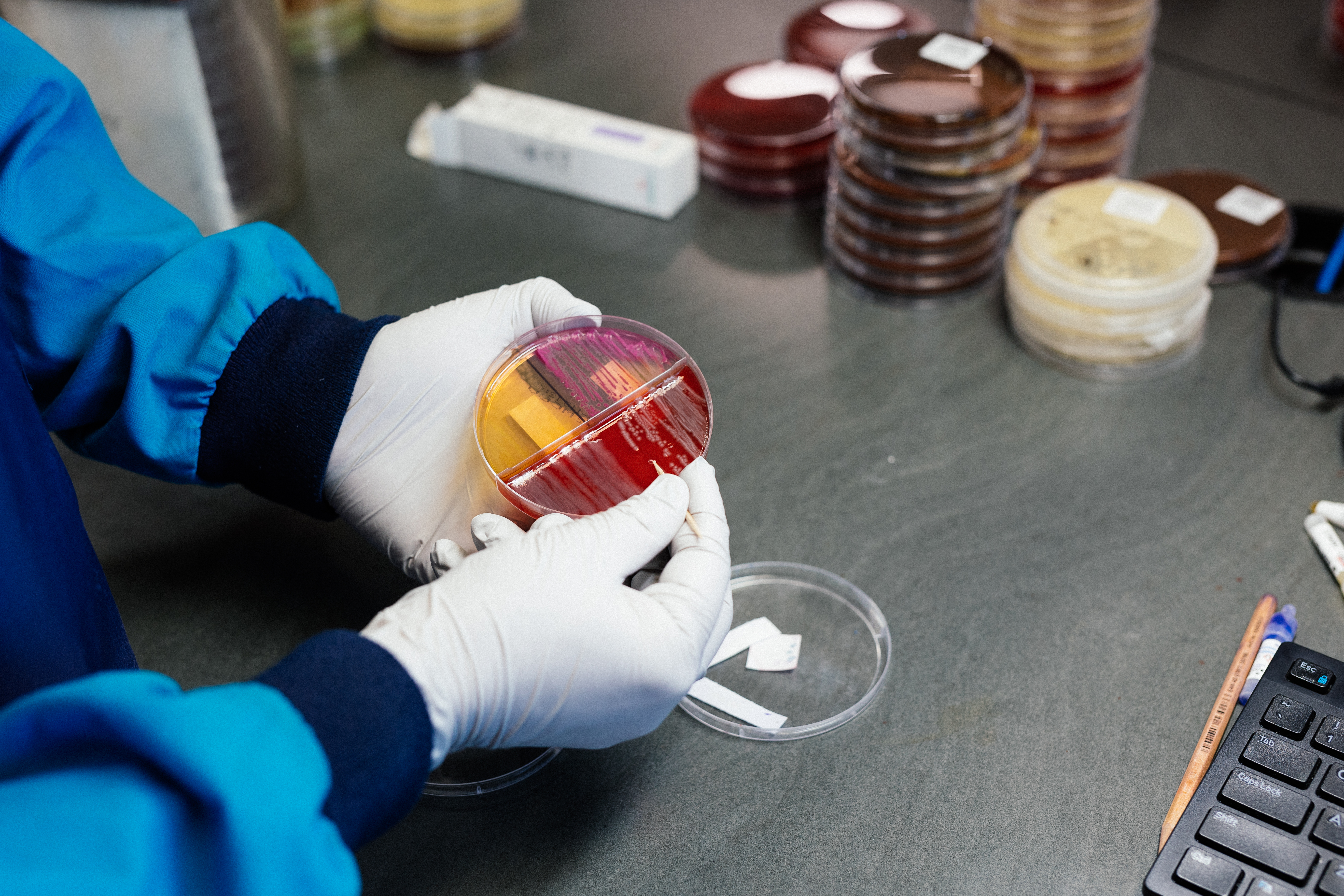 scientist's hands examining microbes on a petri dish